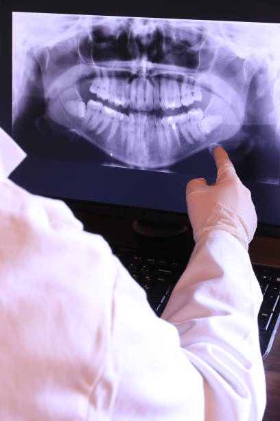 Best Emergency Treatment for Dental Infections or Abscesses in Oakdale, NY