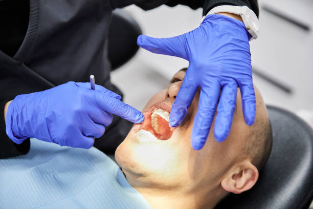 Best Emergency Dental Care for Broken or Chipped Teeth in Oakdale, NY
