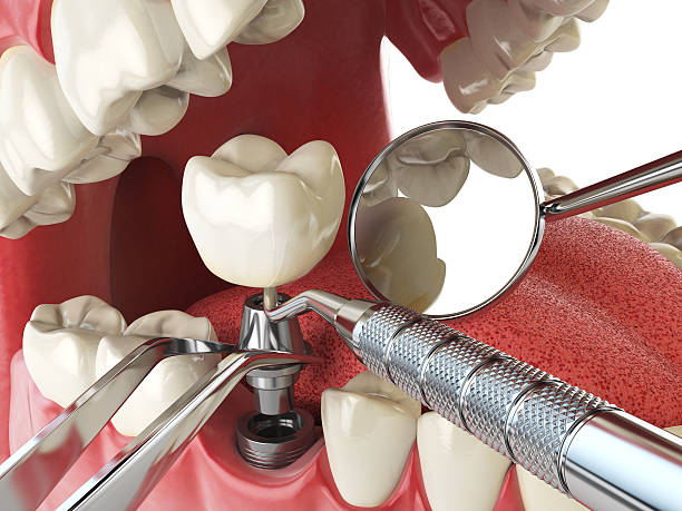 Best Emergency Gum Treatment in Oakdale, NY